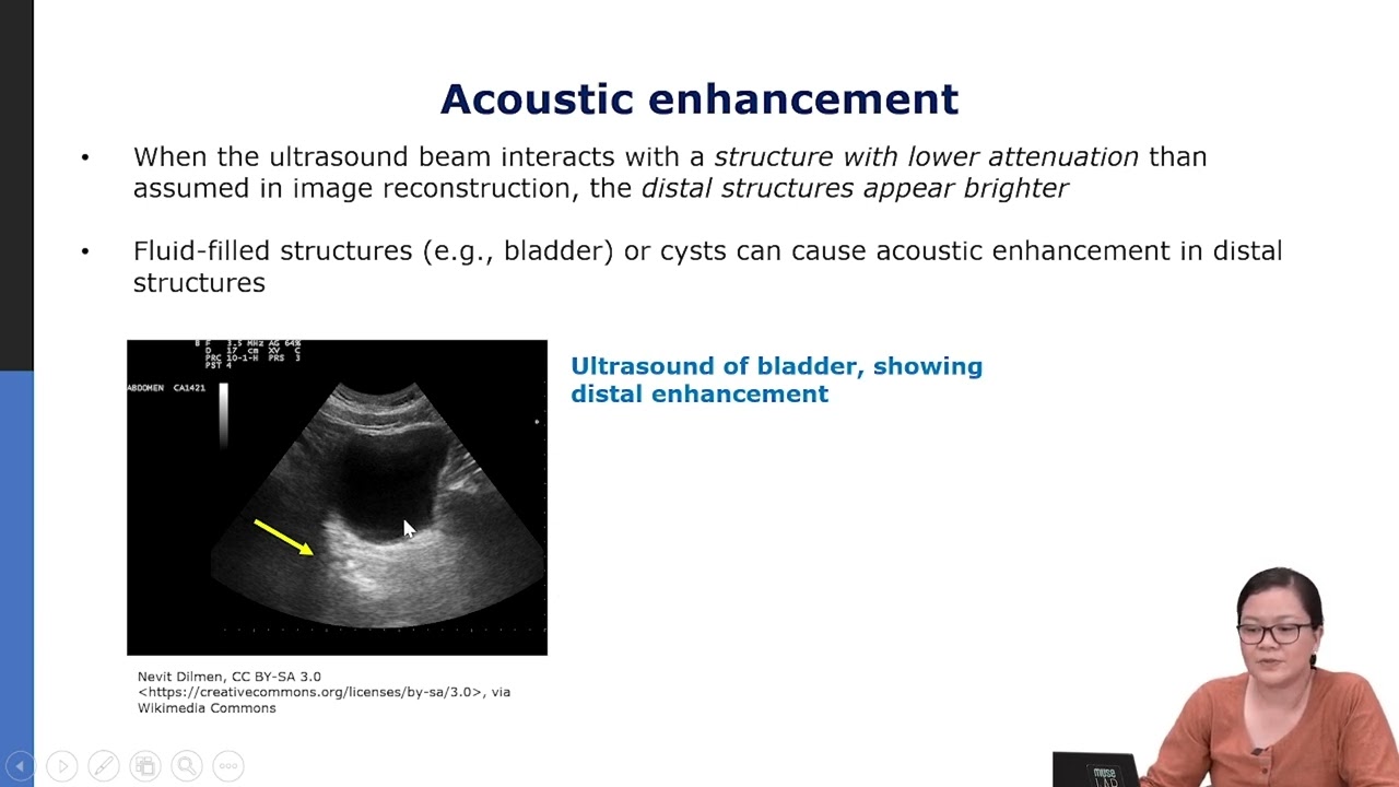 08 Imaging artifacts