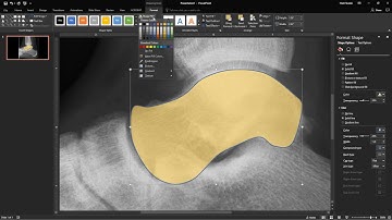 How to make custom shapes to outline anatomy in PowerPoint - Radiology Tutorial