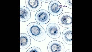 Hep G2 Cells: A Key Model for Liver Biology and Disease