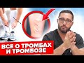 Реальные причины и последствия тромбоза. Как избежать и лечить?