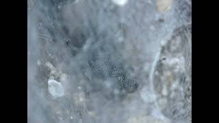 Stenus Sp. Inside Its Silken Pupation Chamber