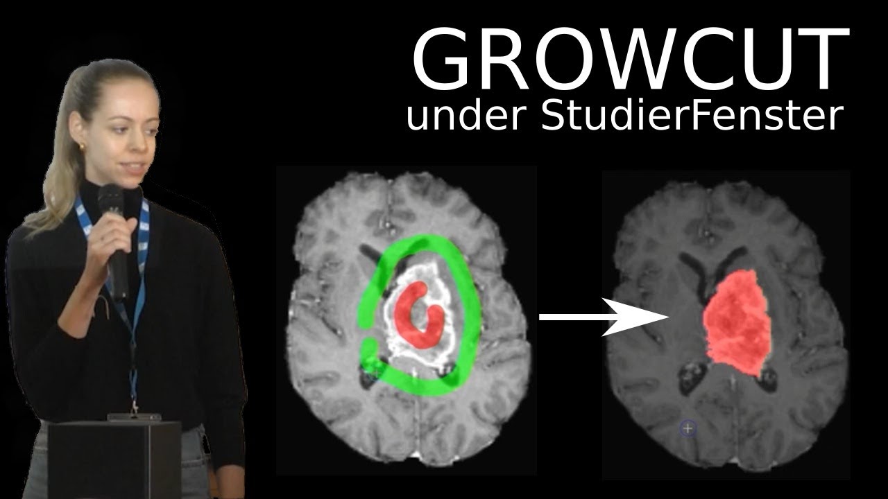 GrowCut under StudierFenster | CESCG 2023 Seminar - YouTube