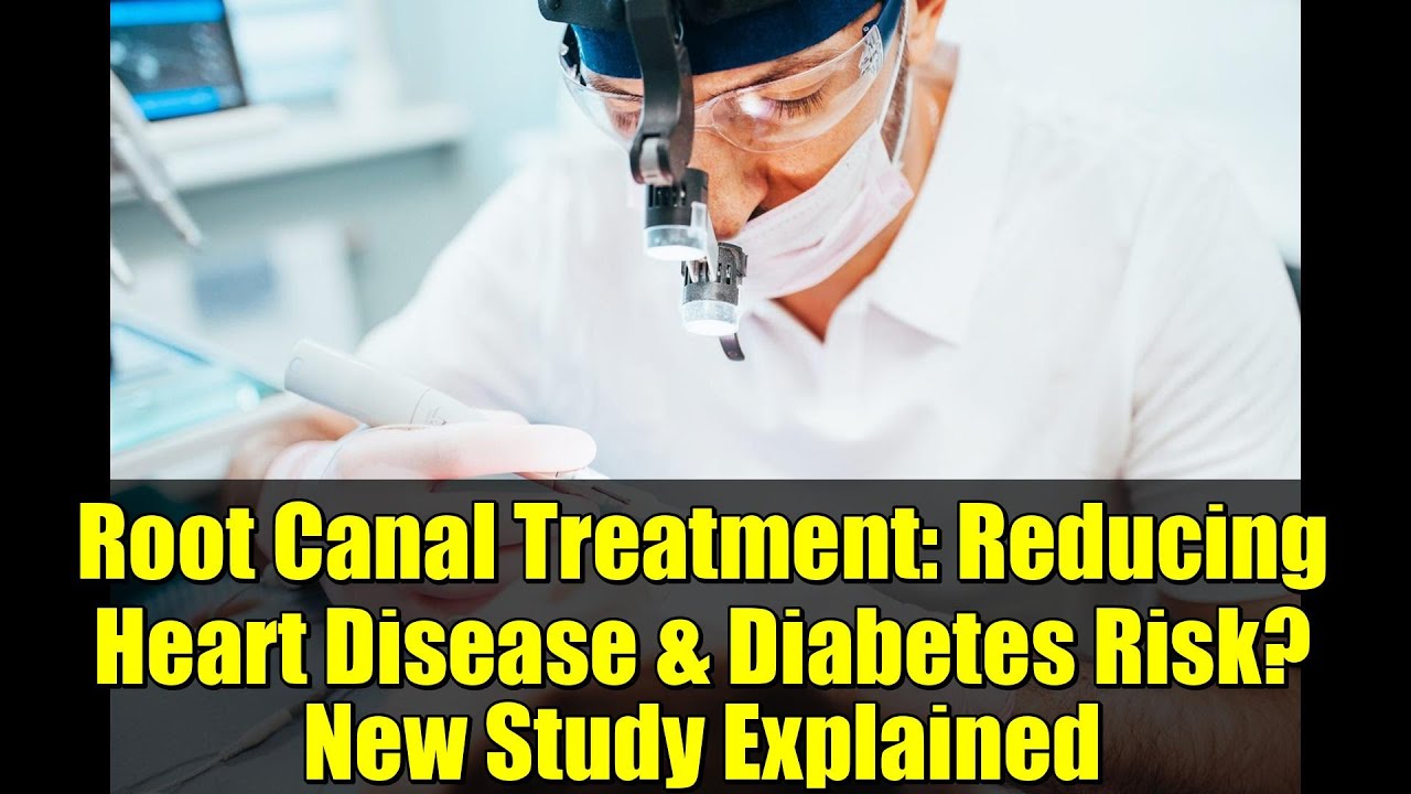Лечение корневых каналов: снижение риска сердечно-сосудистых заболеваний и диабета? Новое исследо...