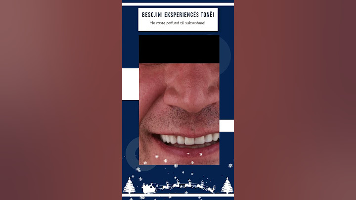 OFERTA PËR FESTA 2023 - IMPERIAL DENTAL CENTER -