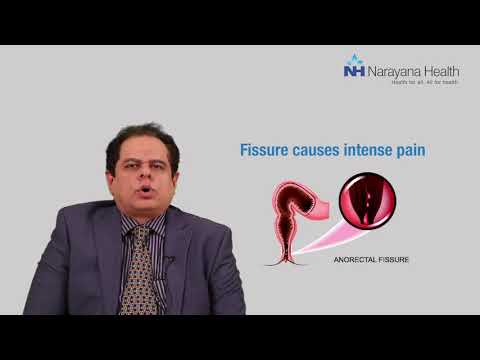 Difference between Piles, Fissures and Fistula | Dr. Vikas Kapur