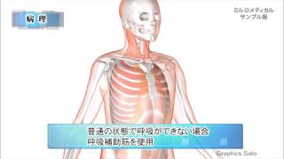 努力性呼吸 2分で分かる医療動画辞典 ミルメディカル Youtube 努力性呼吸 2分で分かる医療動画辞典 ミルメディカル Youtube