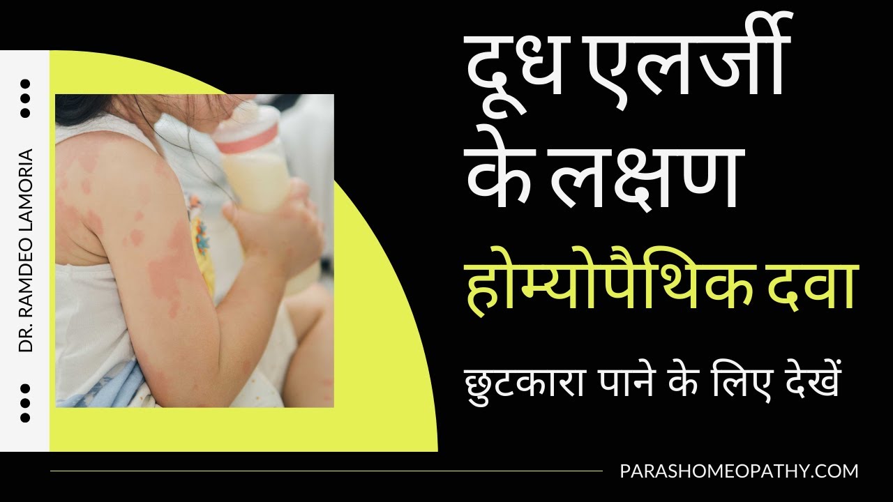 Milk Allergy Symptoms Milk Allergy Homeopathic Medicine Milk Allergy