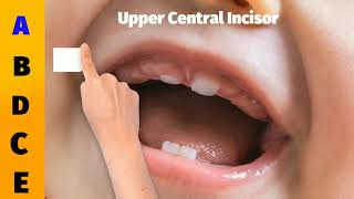 Baby tooth eruption order/sequence of decidious tooth eruption/Easy Mnemonic way to remember