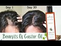 Castor oil benefits a proven solution for hair growth