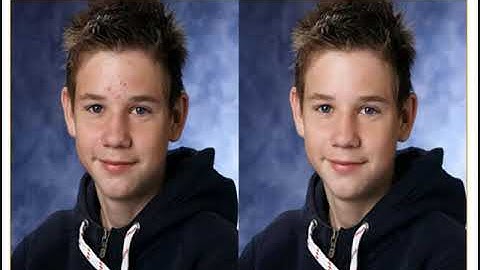 Fundamental Steps in Digital Image Processing