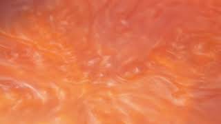 Stellar convection