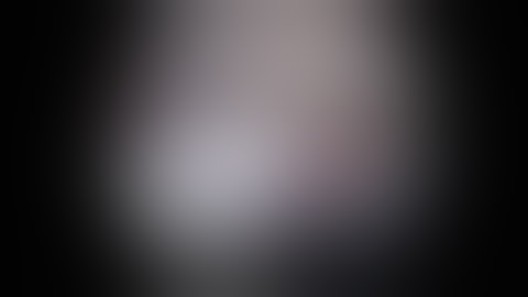 The “Pull-Over” Technique for Arthroscopic Superior Capsular Reconstruction