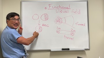 Functional Visual Fields