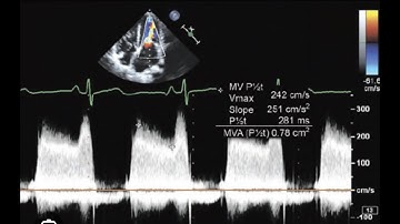 MS Quantifications, Pressure half time, PHT