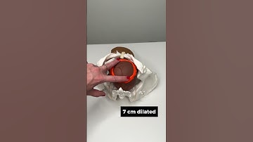 Ever wonder what cervical dilation looks like? ✌️ #pregnancy #shorts #ytshorts