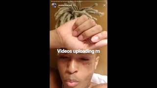 Xtentacion Releases Full Migos Fight