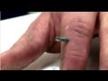 Nail In Finger - Bizarre ER