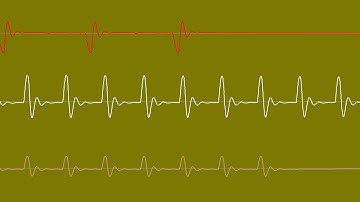COMMODORE C64 SID - 2020 - JAPTN CACK ( AKA CAPTAIN JACK ) - CHRIS-DO/Oscilloscope View