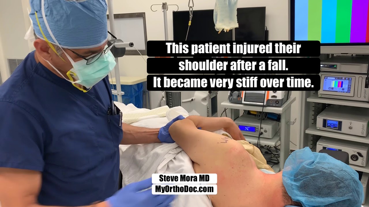 MoraMD: Ortho Surgeon MANIPULATES A VERY STIFF shoulder