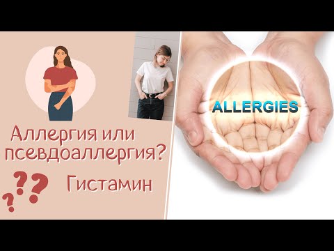 Аллергия или псевдоаллергия? Как их отличить? Гистамин.