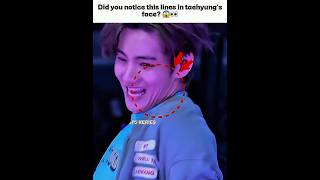Did You Notice This Lines In Vs Face..??