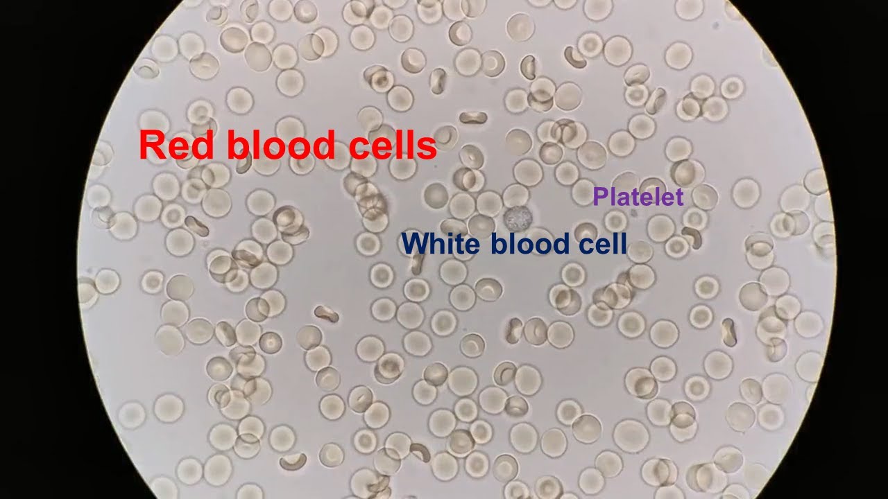 Red Blood Cells Under The Microscope 400X And 1000X Part 1 YouTube Red Blood Cells Under The Microscope 400X And 1000X Part 1 YouTube
