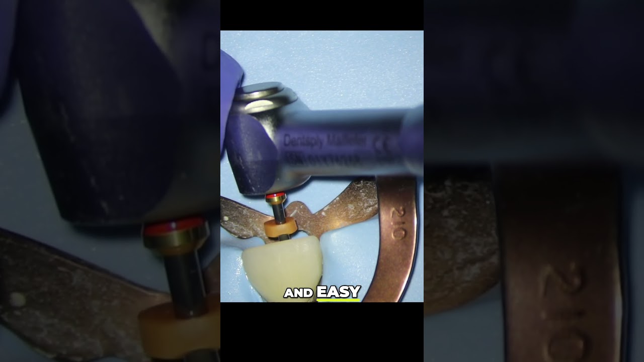 Root Canal  Fast Access, Easy Shaping