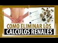 TRATAMIENTO NATURAL PARA PIEDRAS EN EL RIÃ‘ON | COMO ELIMINAR LOS CALCULOS RENALES
