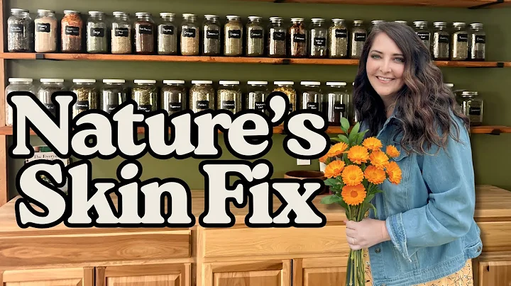 Nature’s Skin Fix: The Calendula Remedy I Use For Eczema, Psoriasis & Rashes