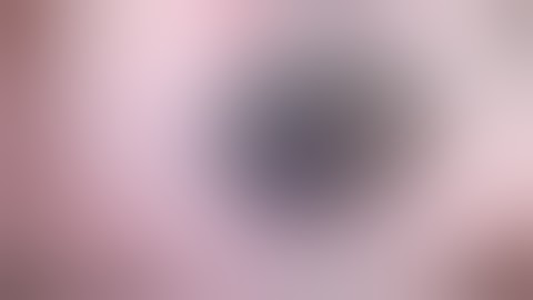 DMEK Triple Procedure