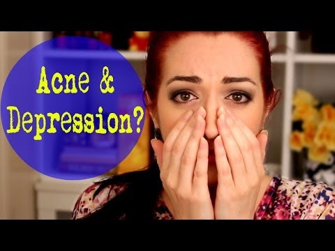 ACNE CAUSES DEPRESSION? How To Get Through It!