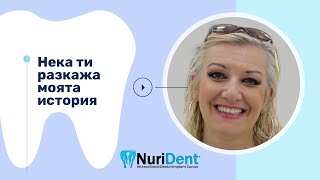 Пълно възстановяване на челюстите след екстракция на всички зъби