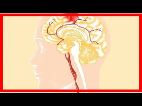 老人患上腦出血還能活多久，聽聽專家怎麼說！