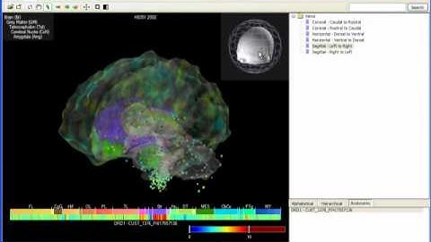 Brain Explorer Youtube Demo