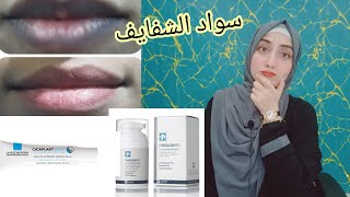 سواد الشفايف الأسباب/ العلاج / كريمات التفتيح