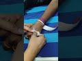 scalp vein set