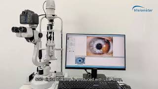 S5D Digital Slit Lamp