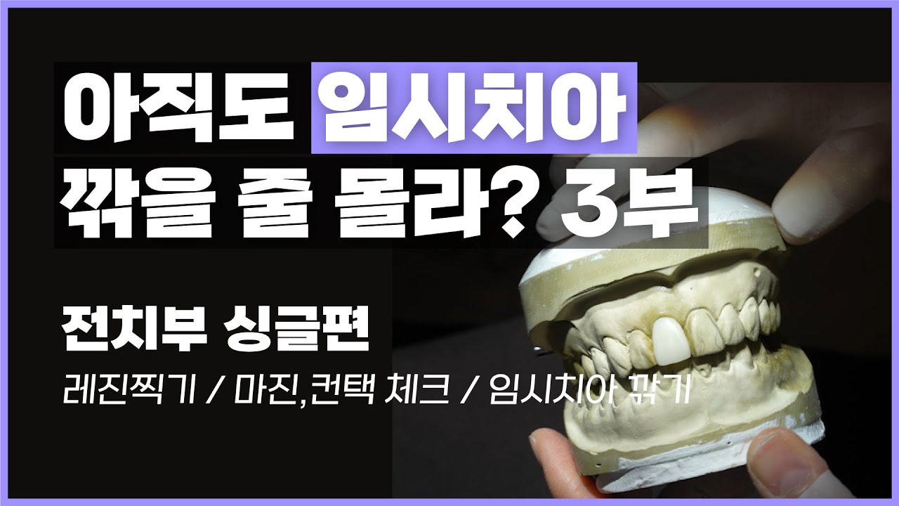 아직도 임시치아 깎을 줄 몰라!?🤪 3부 [전치부 싱글편] (레진찍기, 마진&컨택 체크, 임시치아 깎기)