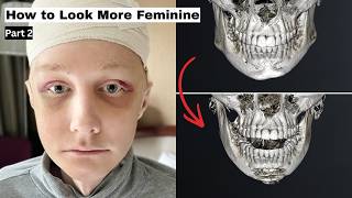 Leah’s Journey in Korea Continues 🇰🇷 | Facial Feminization Surgery | Part 2 #ffskorea