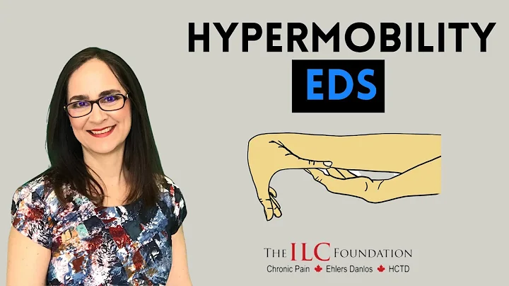 Ehlers-Danlos Syndrome (EDS) and hypermobility by ...