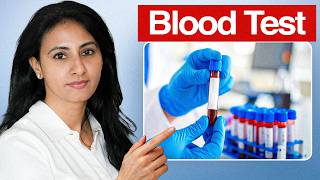 Longevity Doctor Reveals the Truth About Blood Tests