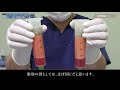 アキーセル脂肪吸引、ベイザー脂肪吸引で採取した脂肪の質、手術にかかった時間、採取脂肪量を比較 #5