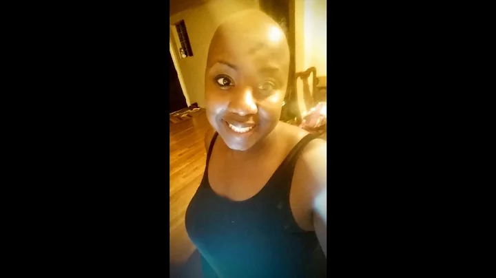 An Open Letter From Me, An Alopecian