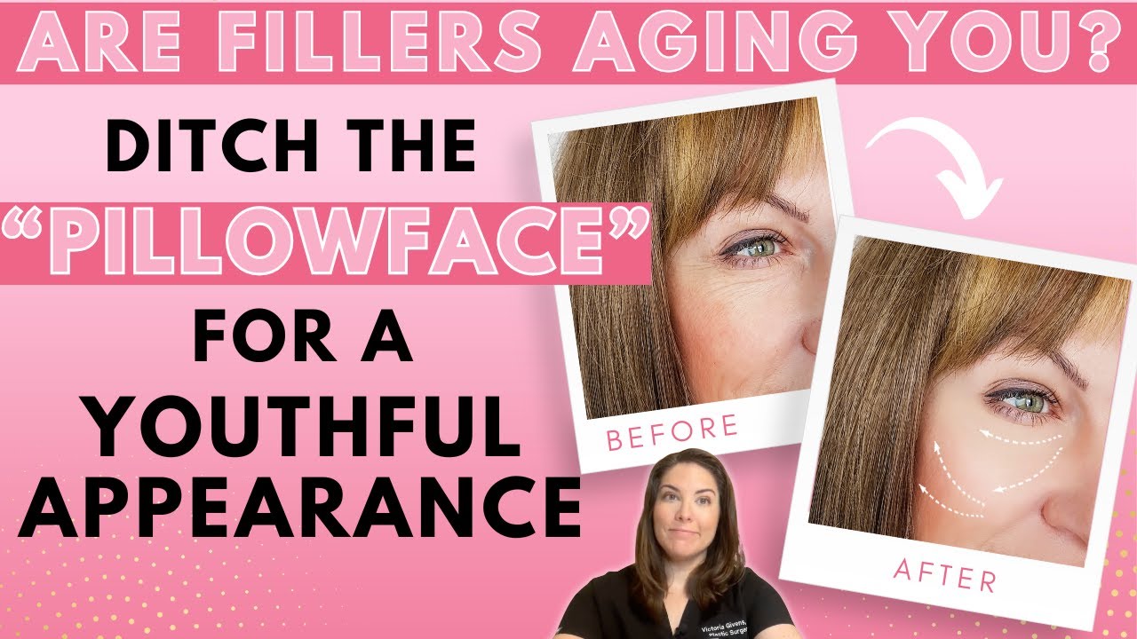 Does Your Face Look Overfilled and Unnatural? How to Avoid Pillowface