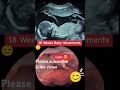 #pregnant #babyheartbeat #pregnan #baby #love #pregnany #pregnancyusg #pregancy
