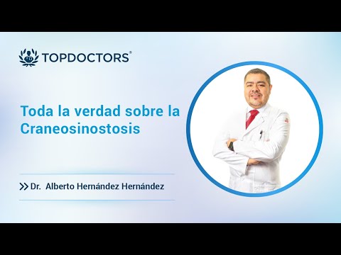 Toda la verdad sobre la Craneosinostosis