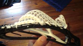 Evo 3 and Surgeon Mesh Stringing