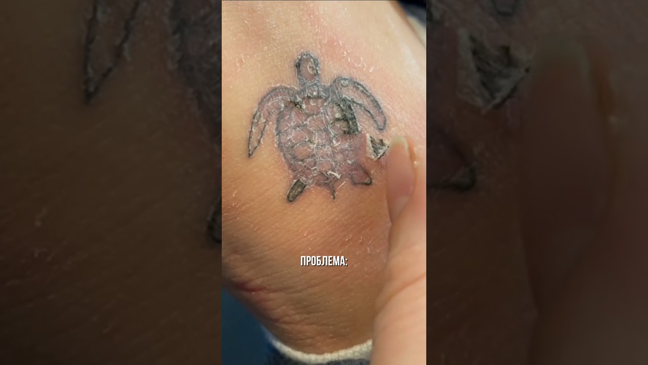 та самая боль, когда тату теряет вид... 