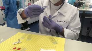 Bsmp And Filarial Smear