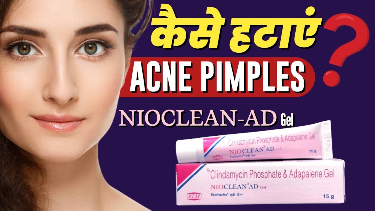 Acne Aur Pimple Kaise Hataye Clindamycin And Adapalene Gel Nioclean